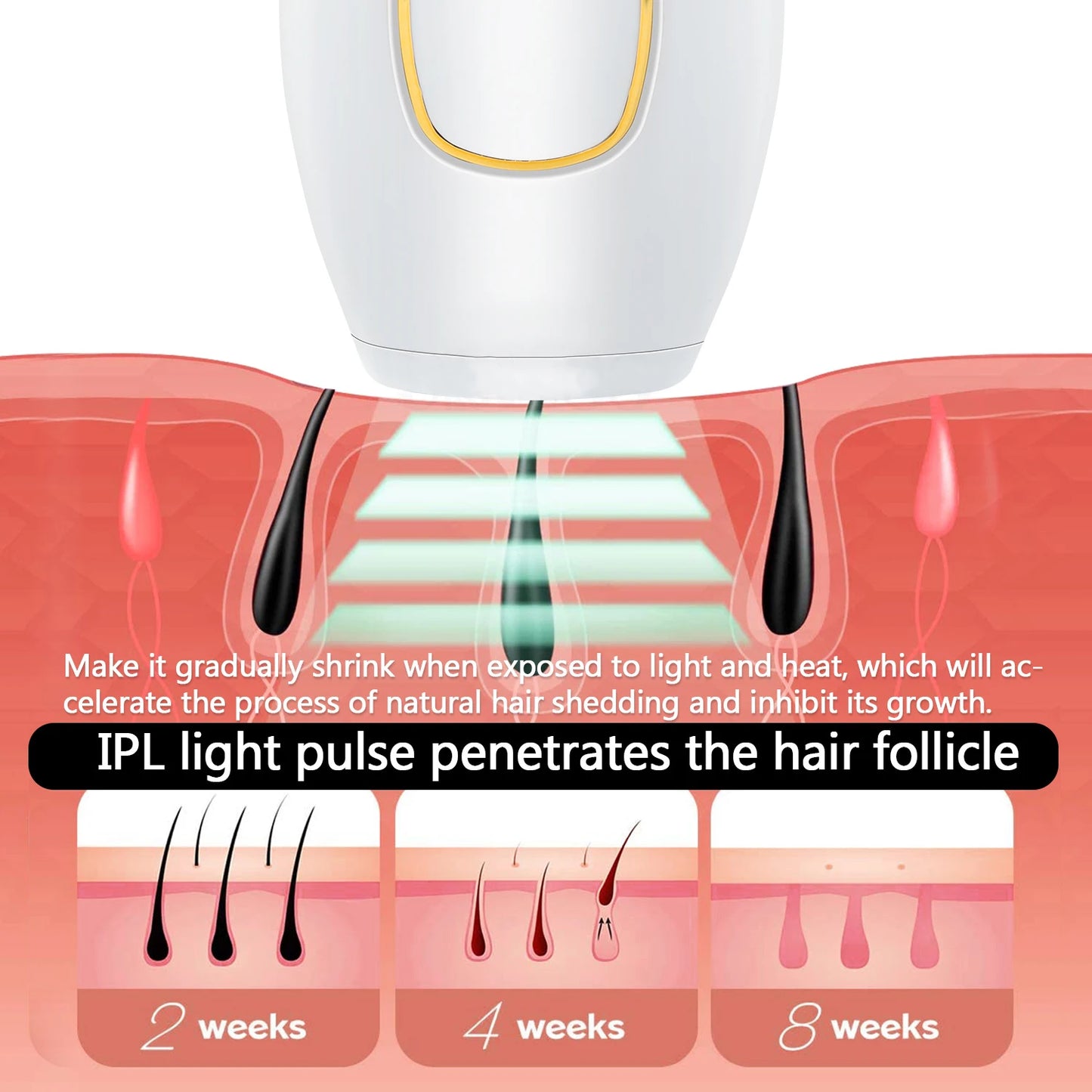 SmoothBeam IPL