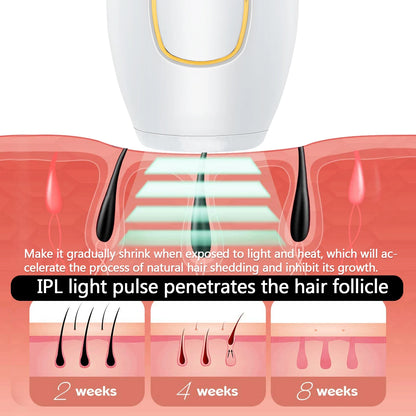 SmoothBeam IPL